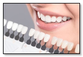 dental bridge shade color guide in use